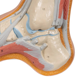 Squelette d'un pied creux (Pes Cavus) - My Podologie